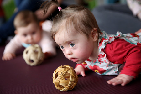 Baby mit Trisomie 21